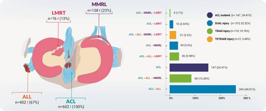 ACL injuries with frequent ALL, medial and lateral meniscus involvement.