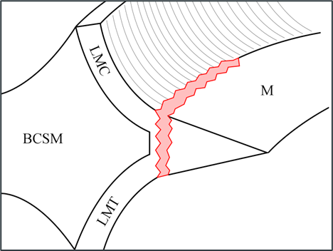 Vertical medial meniscus tear along the meniscotibial ligament.