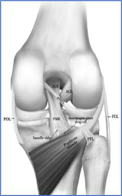 Arthroscopic view of the posterior cruciate ligament (PCL).