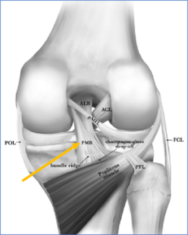 Arthroscopic view of the posterior cruciate ligament (PCL).